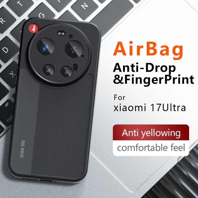 For Xiaomi 17 Ultra Case High- - Photography Kit Xiaomi 17 Ultra 评论和价格
