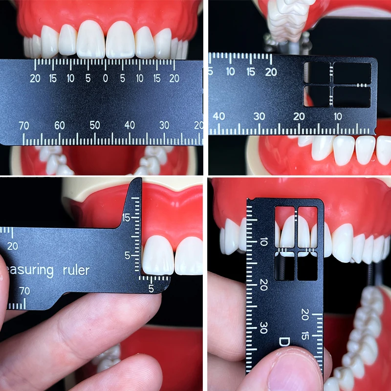 Autoclavable Dental Precision  - Photography Rules 评论和价格